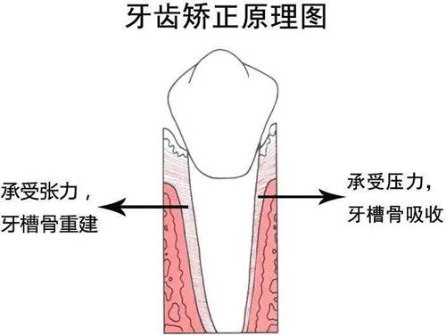 邢台正畸专家：矫正牙齿会不会造成牙齿松动？(图2)