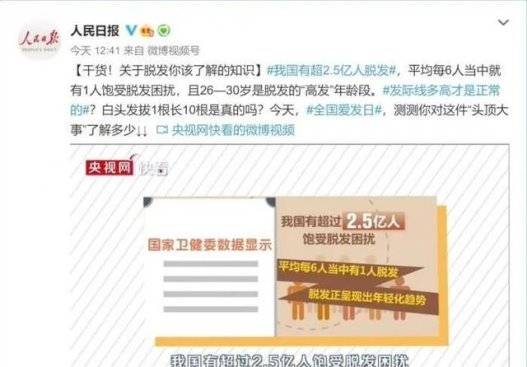 2.5亿脱发问题何解？米诺地尔哪个品牌好用？蔓迪还是达霏欣？