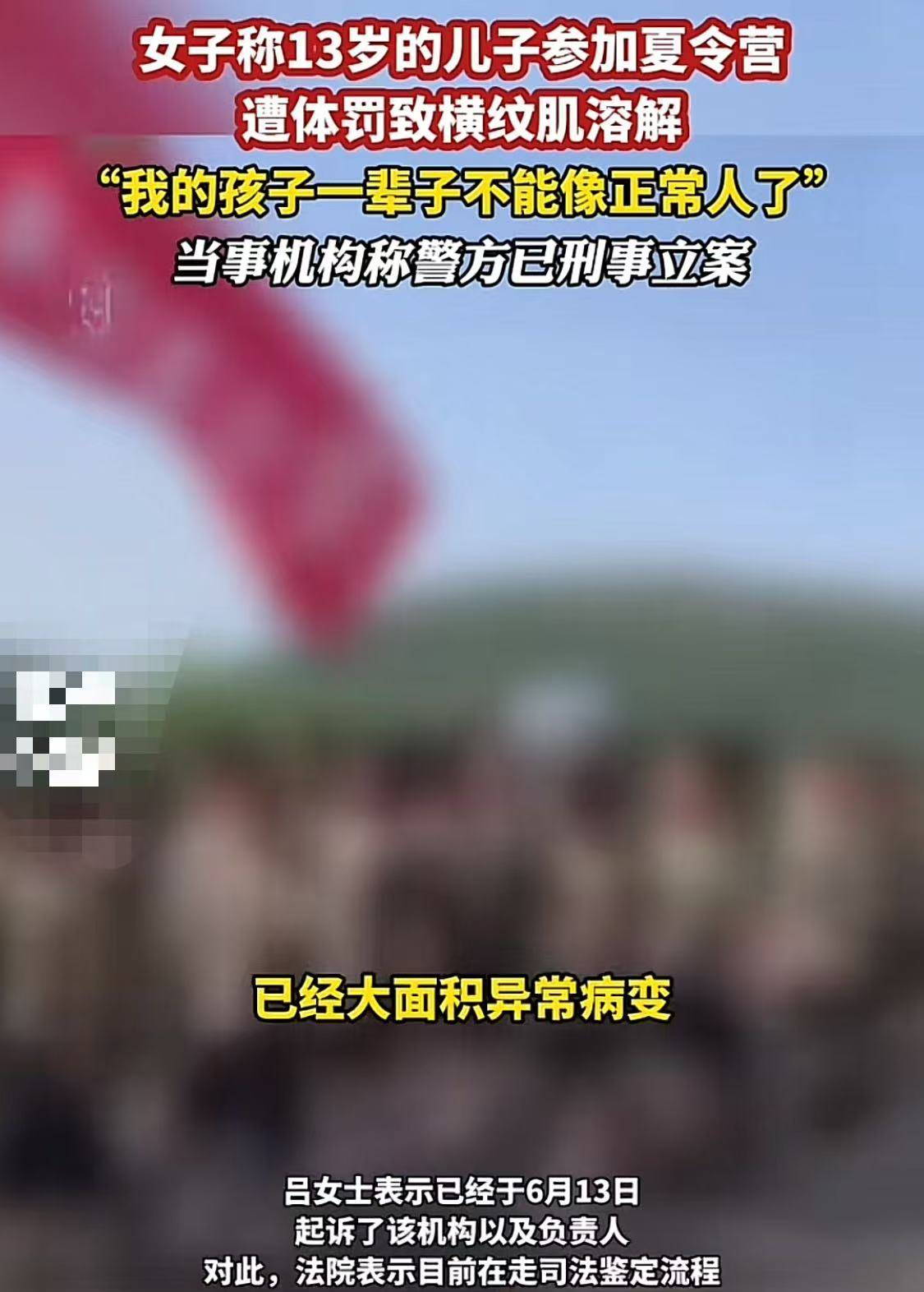 江南体育注册山东一13岁男孩遭夏令营教官体罚至终身残疾患重度以上抑郁家属发声(图5)