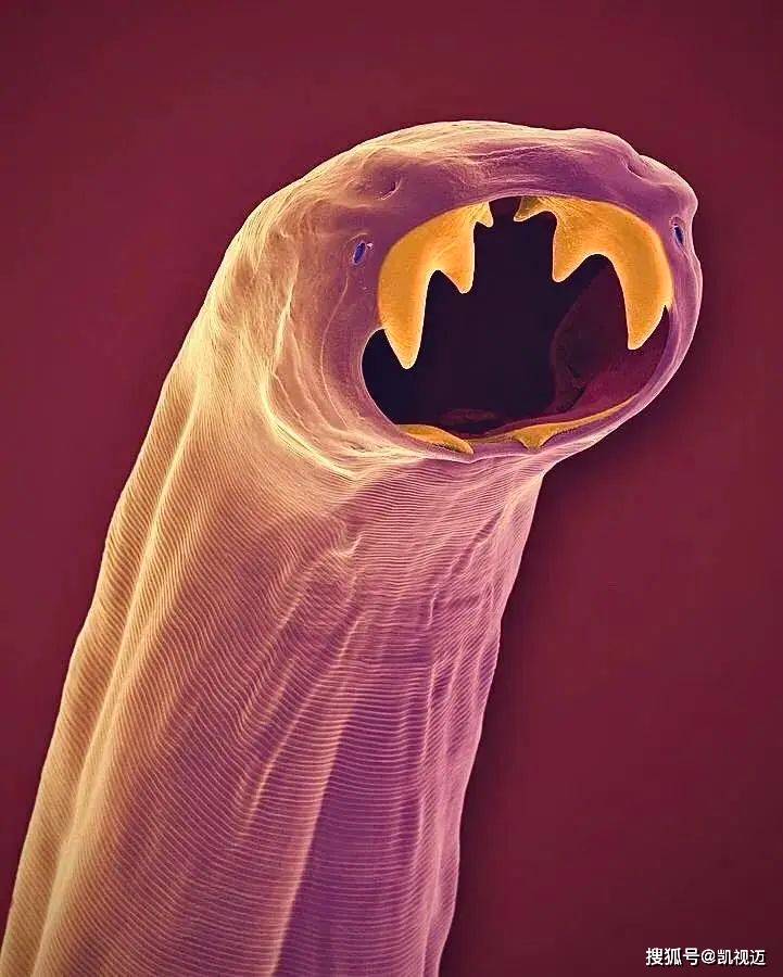 显微镜下的微生物世界：微观中的大宇宙