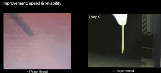 马斯克脑机接口公司重大突破，1.5秒快速植入电极，万人等待上脑