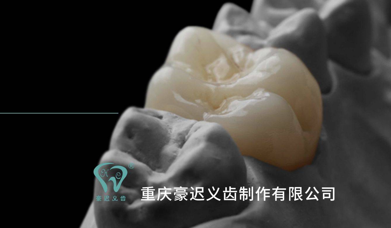 从产能到口碑：2026重庆优质义齿品牌全