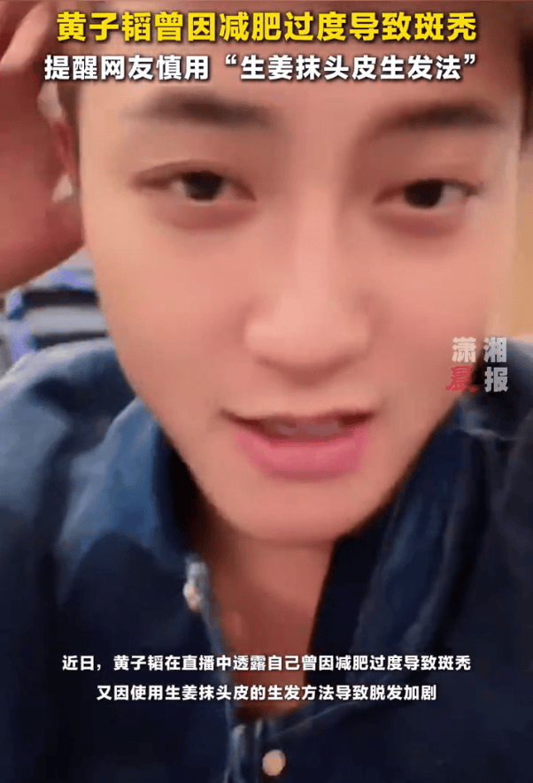 黄子韬否认秃顶传闻！自曝因过度减肥导致斑秃，用生姜抹头导致脱发加剧