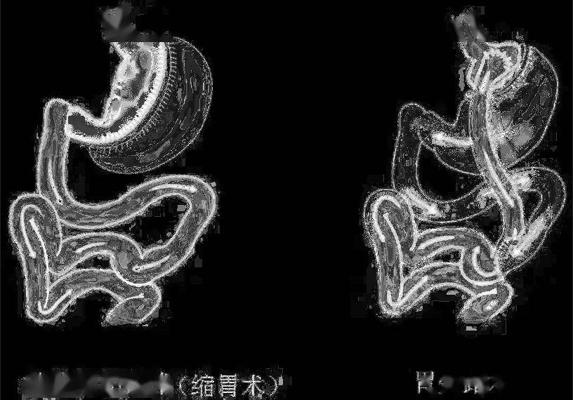 橙柿互动🌸管家婆一肖-一码-一中一特🌸|中秋佳节，健康先行：五类特殊人群如何安心享用月饼  第4张