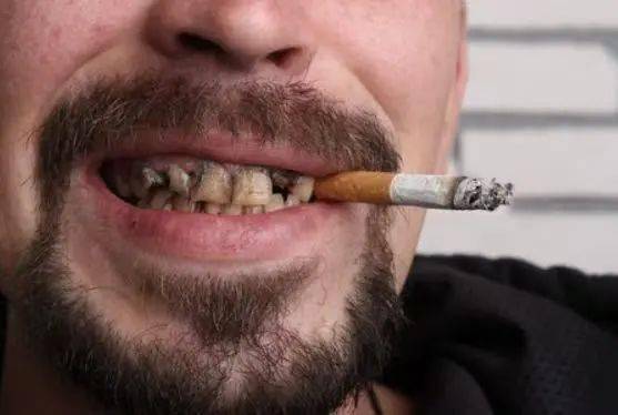 吸烟损伤的不仅是肺，还有您的口腔健康