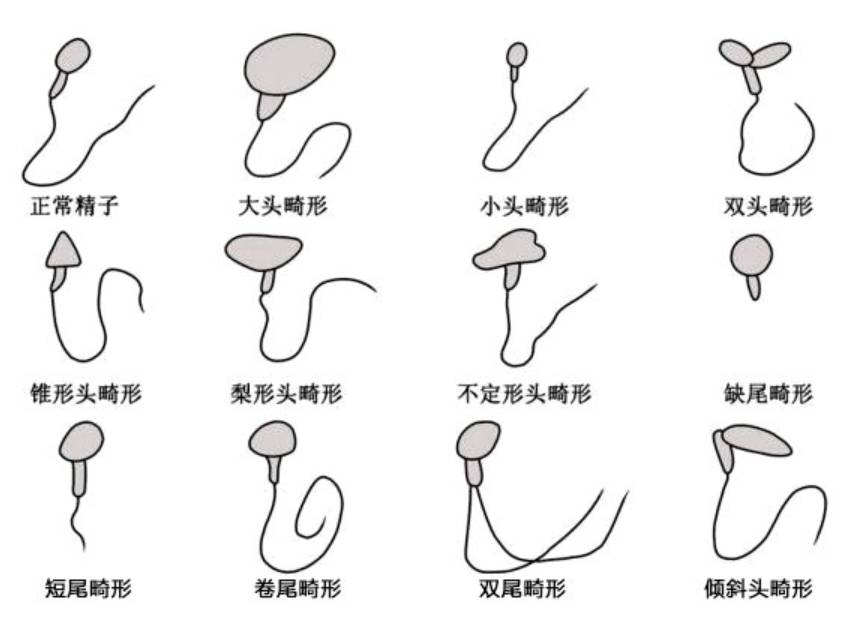 关于精子的30个冷知识1精子也是看颜值的丑的不配谈恋爱