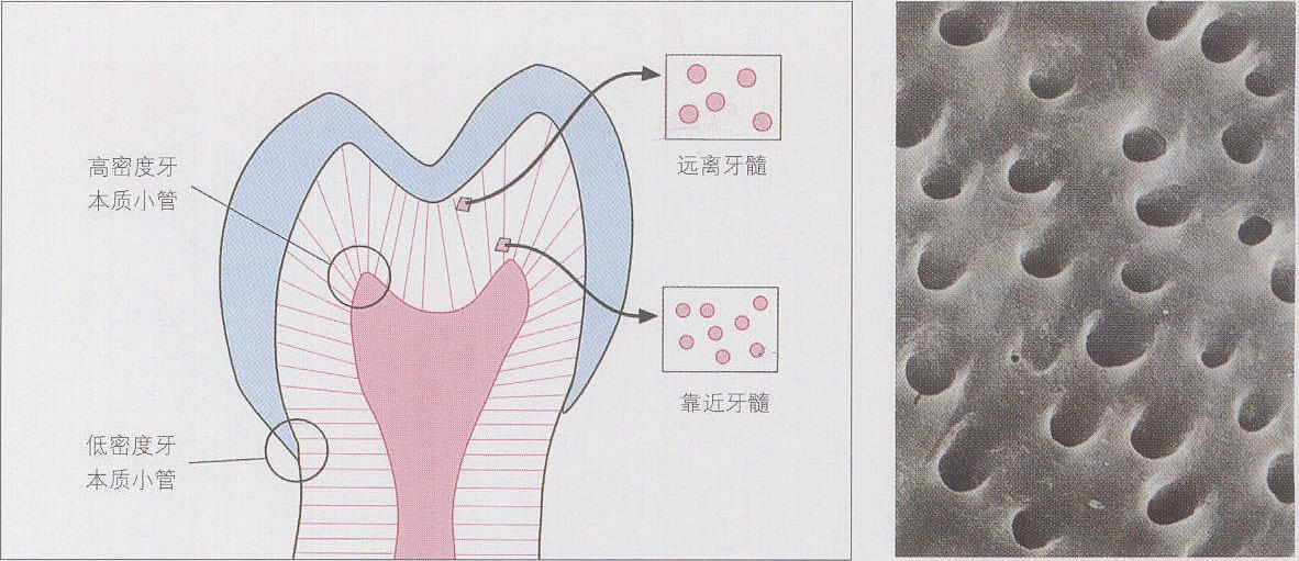 昆明口腔科普:脫敏牙膏真的有用嗎?_牙齒_牙髓_治療