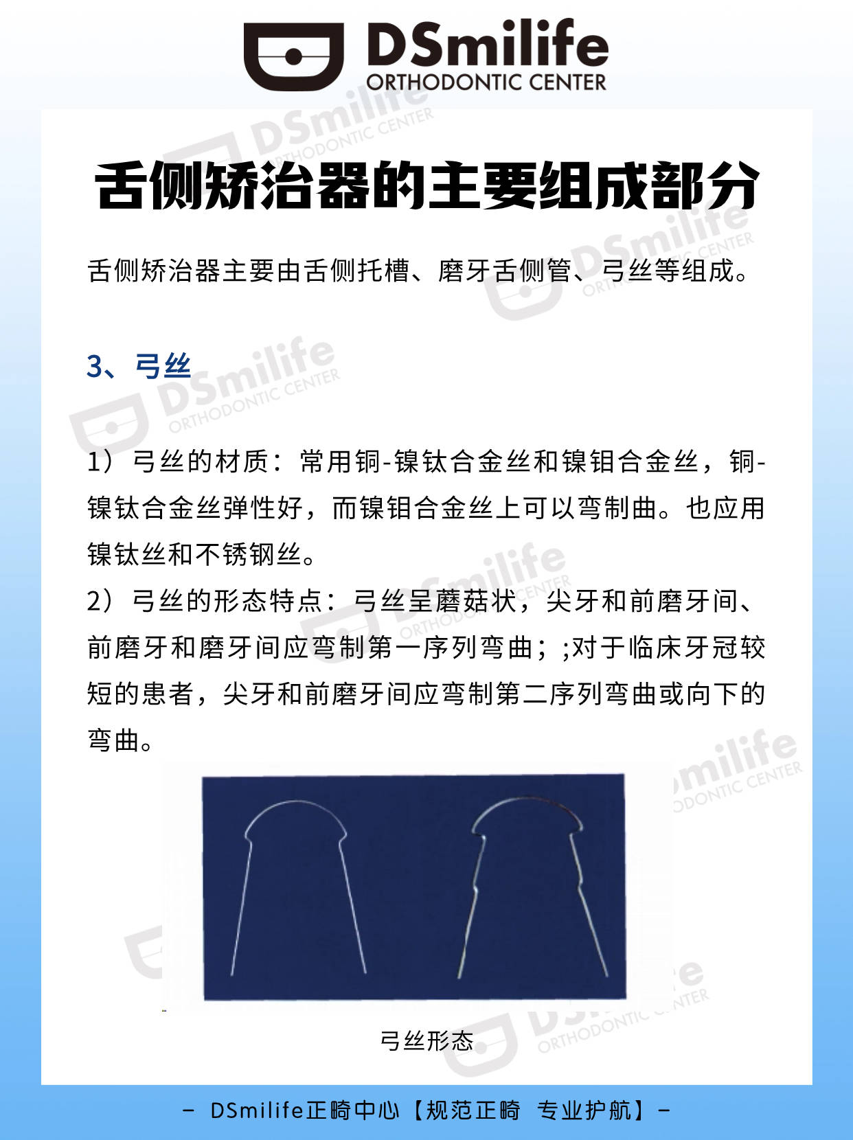 ds正畸|舌側矯治器的主要組成部分_槽溝_臨床_前牙