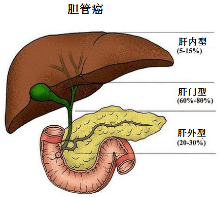 成都普濟中醫藥研究院樊君:膽管癌如何治療?_患者_癌細胞_惡性腫瘤