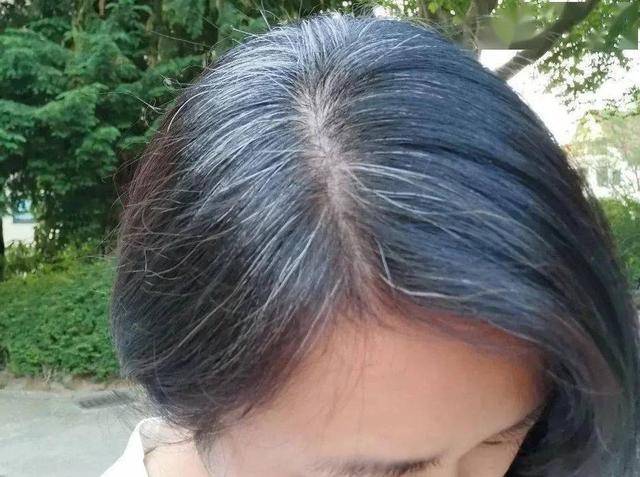 白发长在哪,病就在哪出?