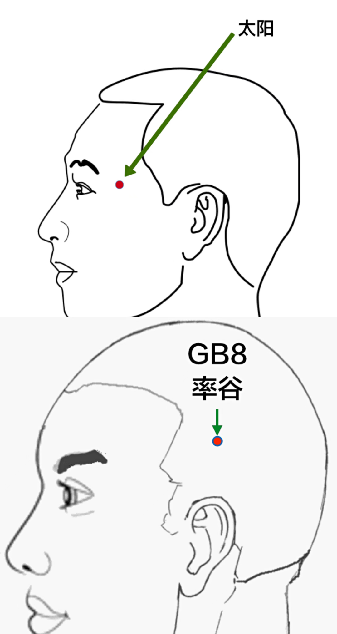 一針二穴 | 我學倪師透針透穴的個人筆記,共31條_治療