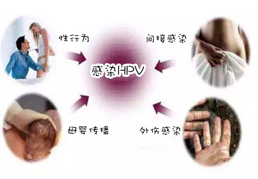 不小心感染了hpv阳性怎么办