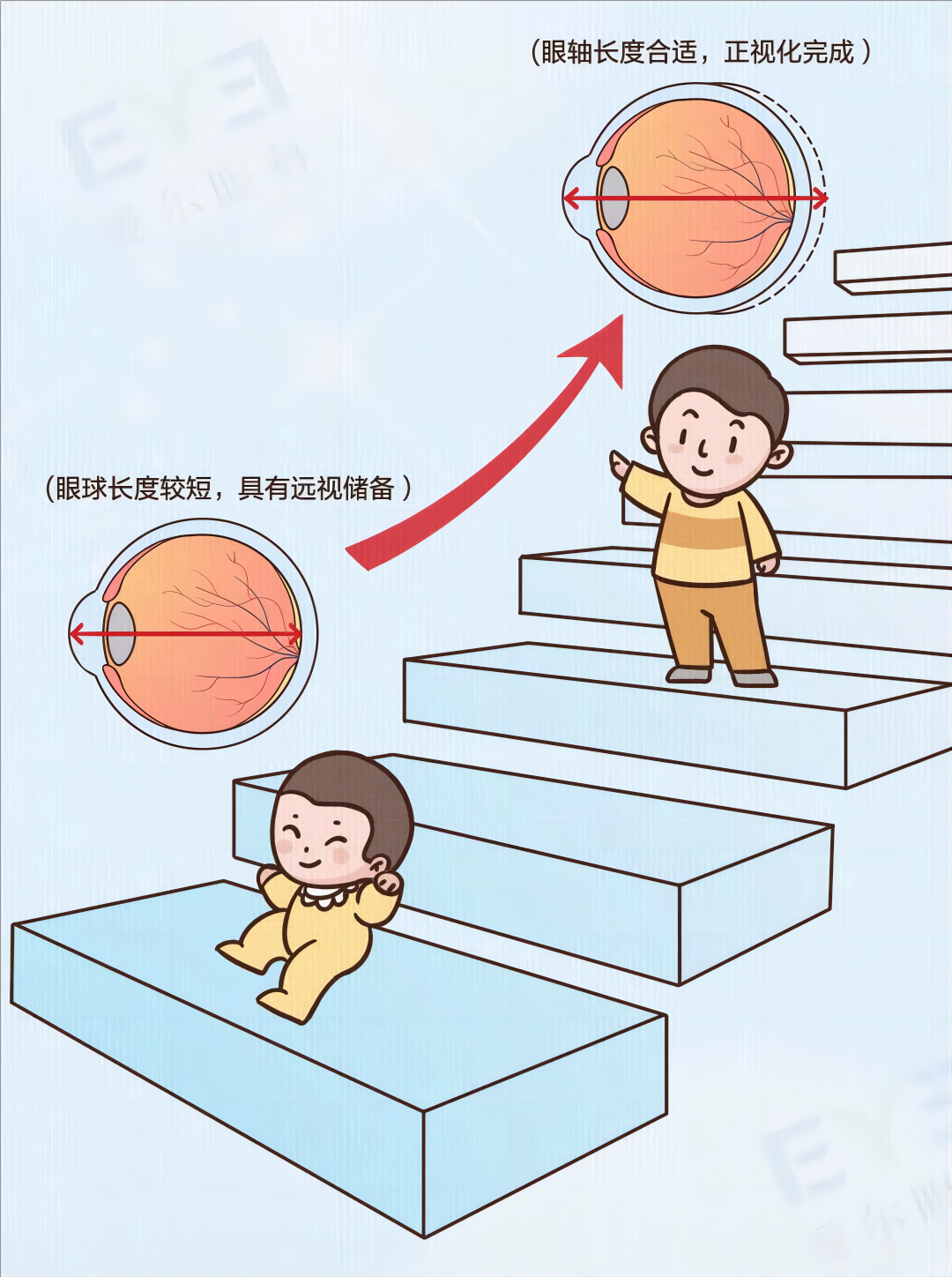 网传近视眼800度降到100度的方法,可信吗?_角膜_检查_控制