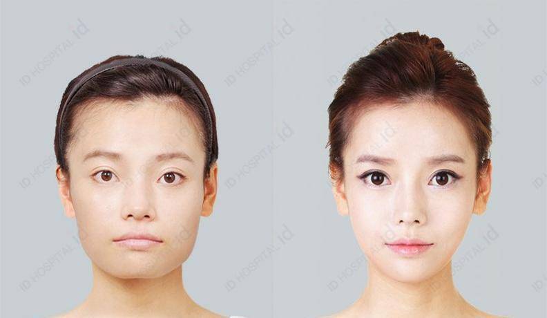 那些削骨的女星脸还好吗?杨幂,鞠婧祎开始崩了,后遗症明显