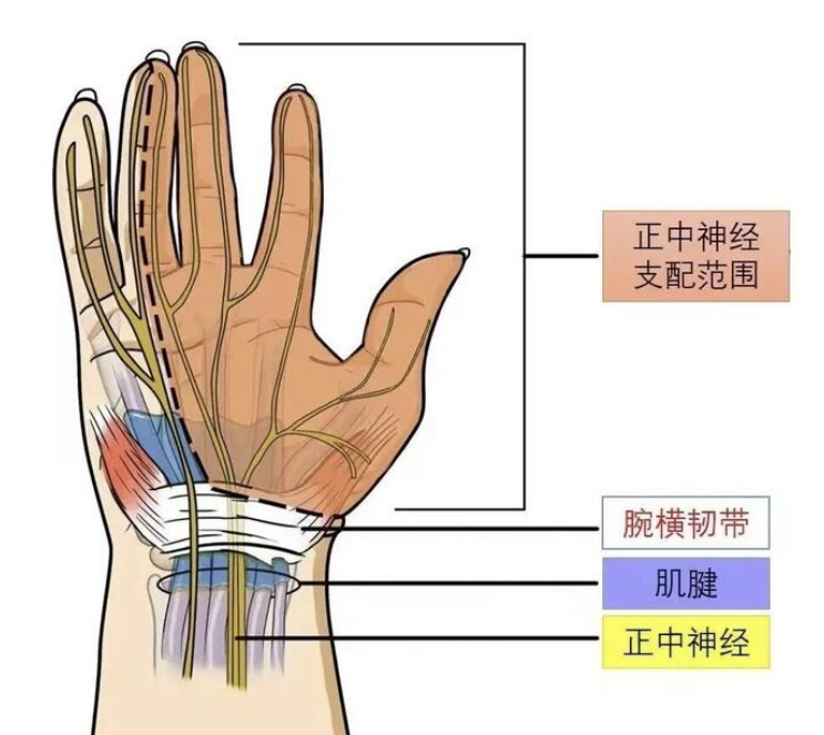 鼠标手狭义的讲就是腕管综合症,是指人体的正中神经,以及进入手部