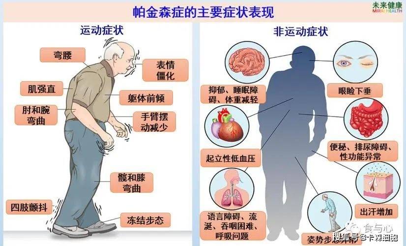 重大疾病包括哪些病图片