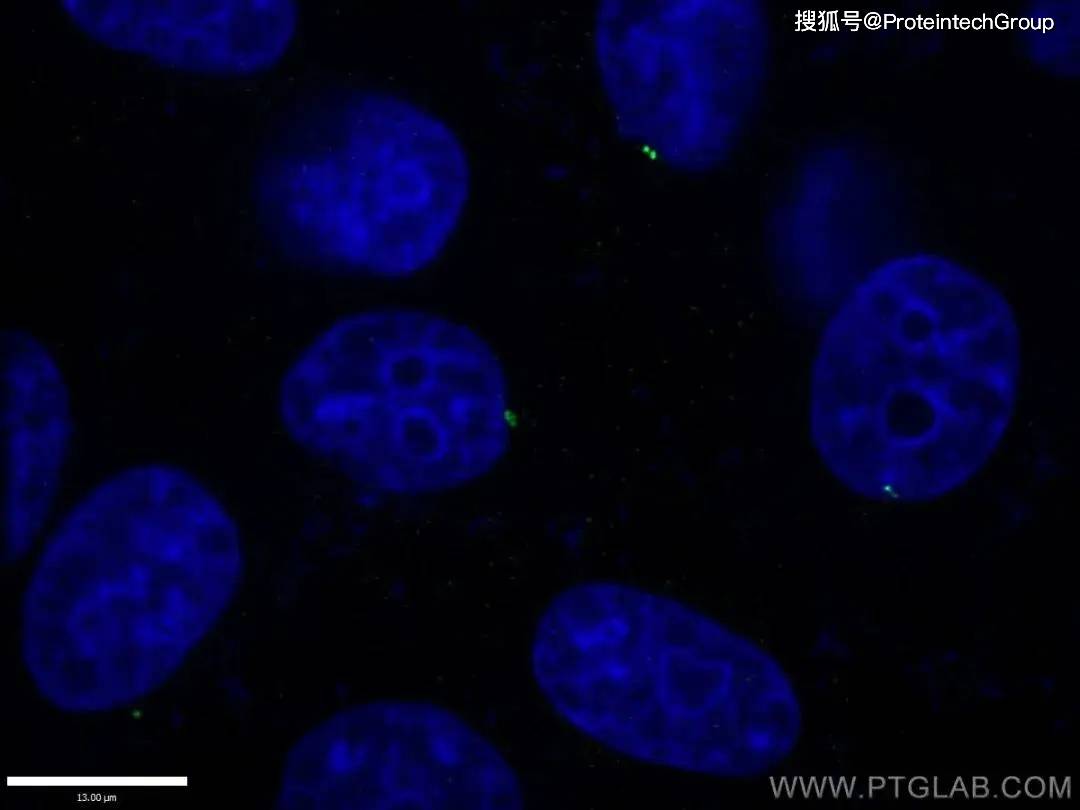 免疫熒光(if)常用細胞器標記物指南!_marker_蛋白_高爾基體