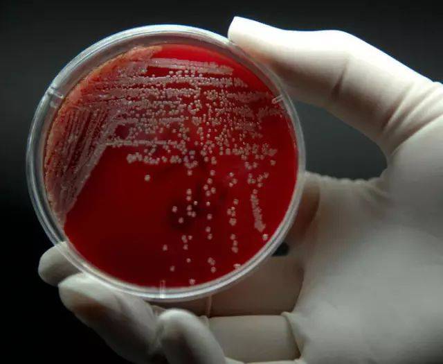 常见的微生物接种方法优缺点_菌落_平板_培养基