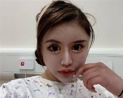 还记得13岁就整容的网红女孩吗?