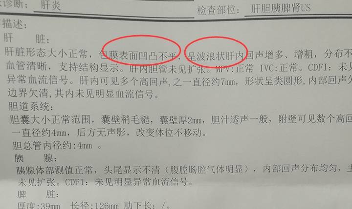 乙肝小三阳检查报告单图片