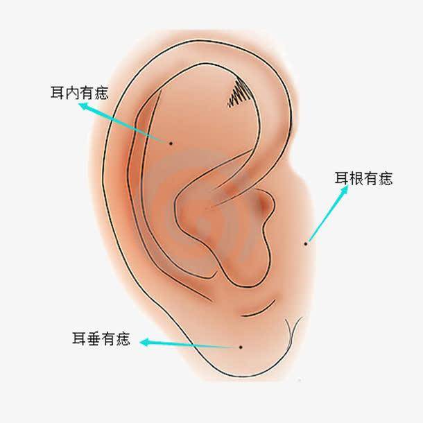 耳垂命运图图片
