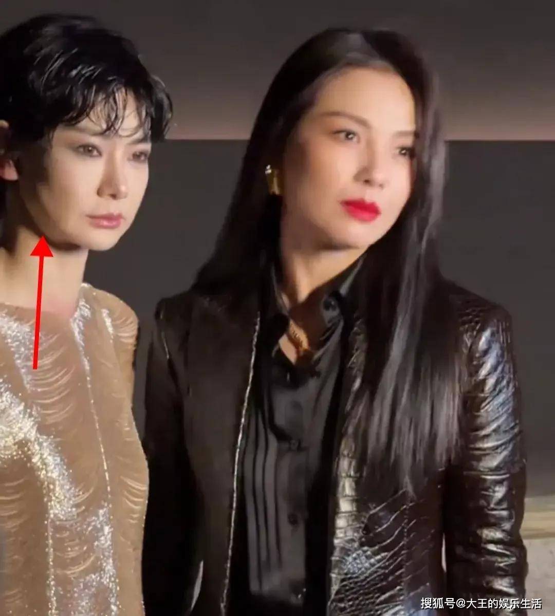 40岁戚薇近照:瘦成纸片人,面部松弛,下垂严重,被指像个小老太_状态