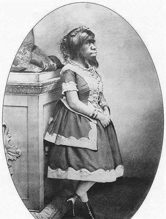 她身高1米38,拒绝20个求婚者,活着被当摇钱树,死