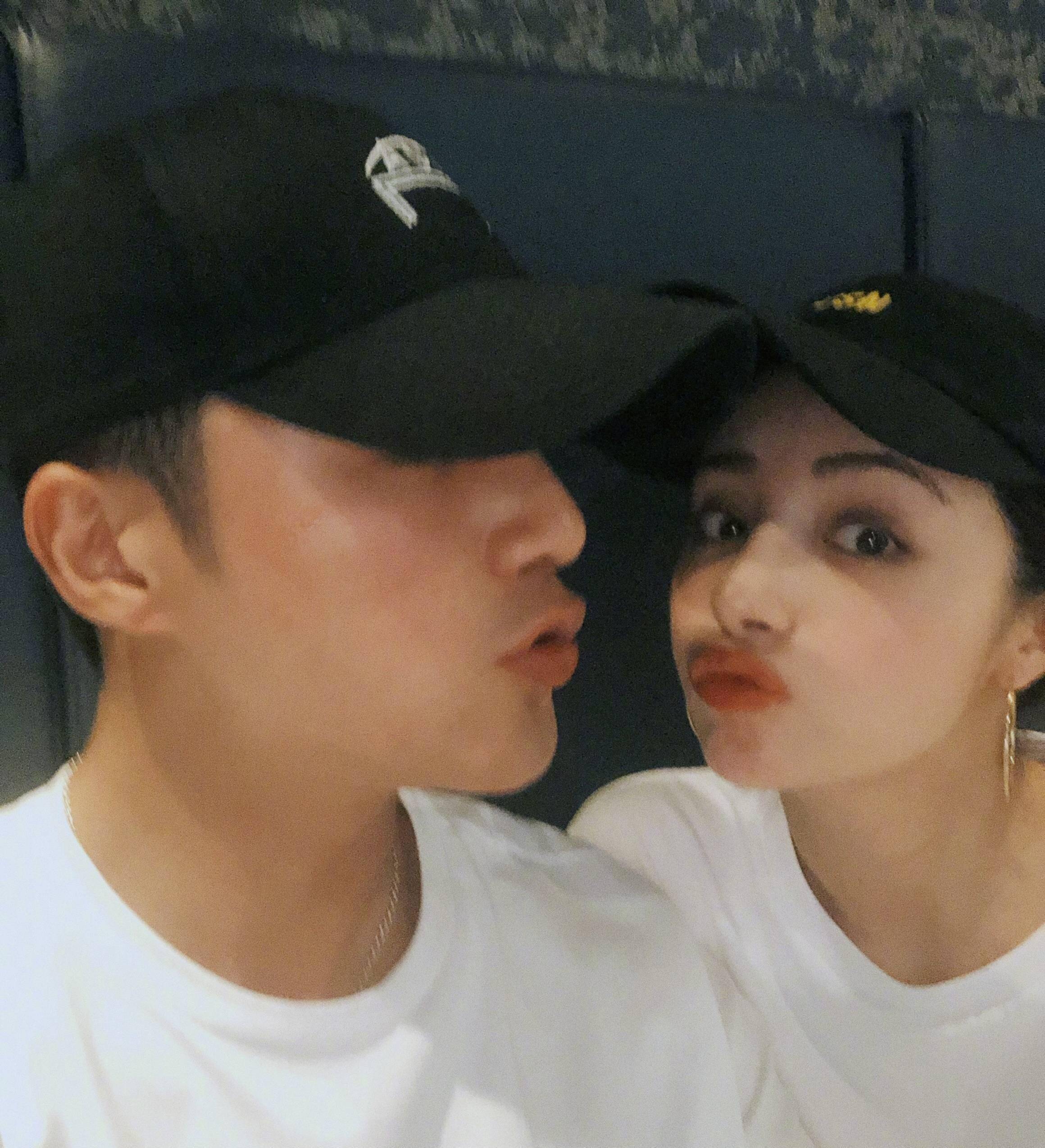 姜潮智齿发炎,肿成鹅蛋脸.