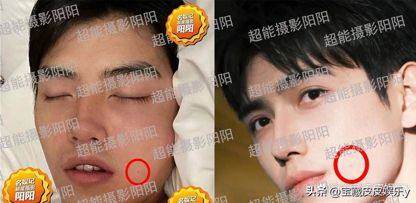顶流恋情大瓜男生是陈飞宇?近照中耳朵嘴角的痣都一致,实锤了!
