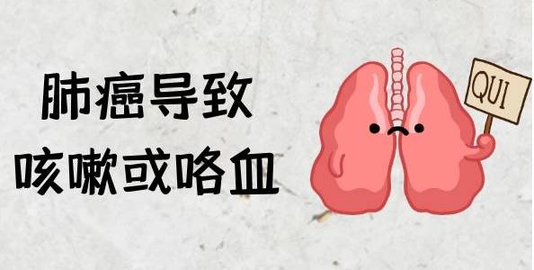 肺结核是由结核杆菌引起的传染病,其典型症状包括持续咳嗽,咳痰,咯血