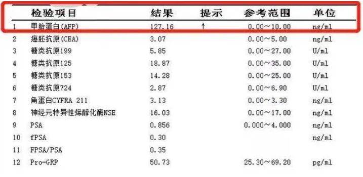 因此,如果异常凝血酶原的数值出现异常升高