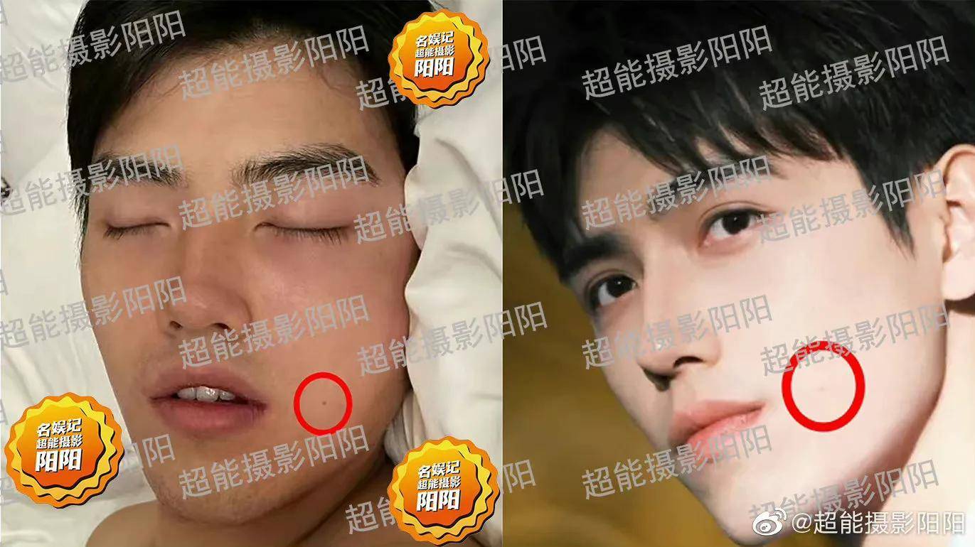 经过阳阳以及网友的对比,发现近照中男生的耳朵,嘴角的痣就是陈飞宇