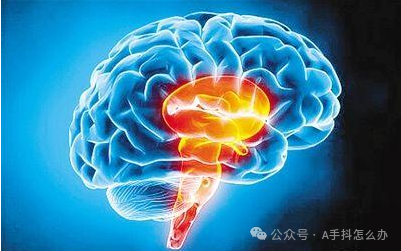 惊人发现帕金森病患者睡前做这三件事效果惊人