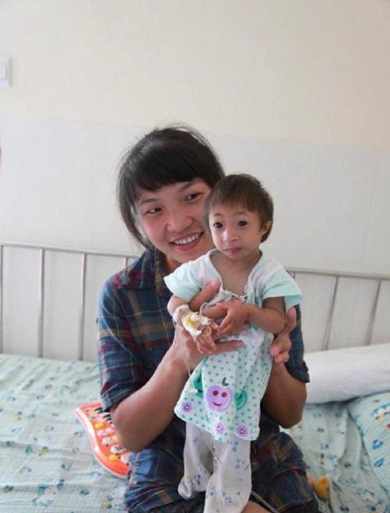 湖南"猴孩":出生时仅有2斤一两,4年长21cm,马戏