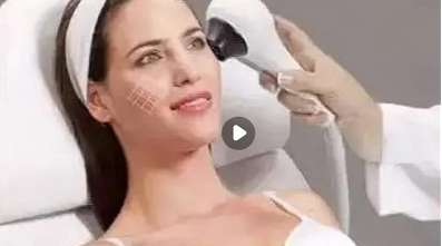 针 对于面部提拉,瘦脸,超声炮有明显的效 果,超声泡作用层次可分为