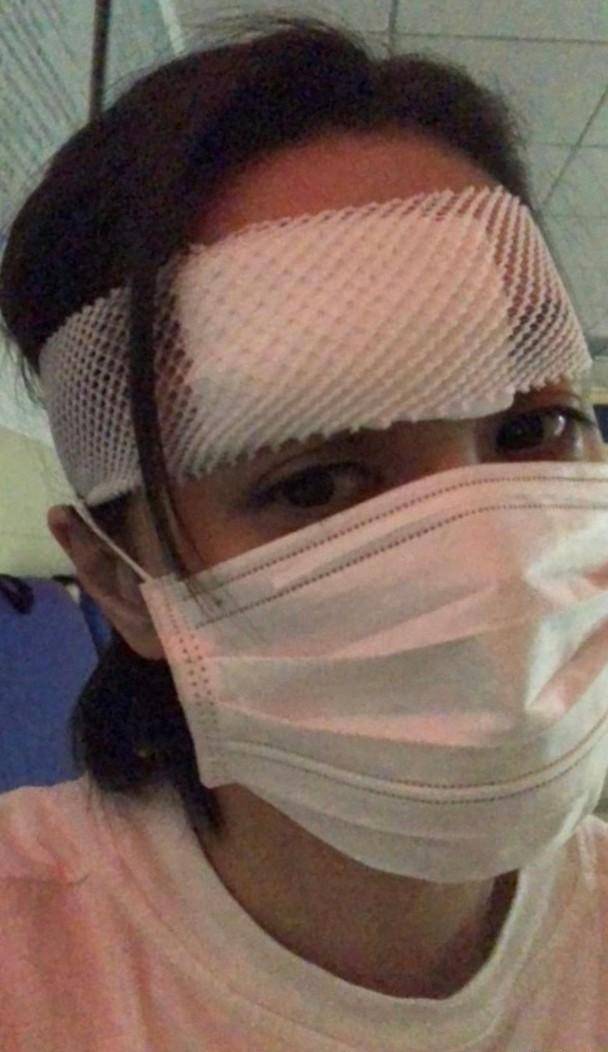 需缝几百针任达华介绍阿娇顶级整形医院霍汶希曝光其现状