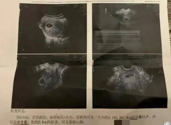 72岁张纪中与42岁妻杜星霖宣布怀上第三胎晒验孕棒和b超单