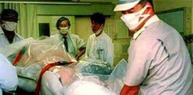 原创1999年日本发生核泄漏伤者全身溃烂贴胶布被医生强行续命83天