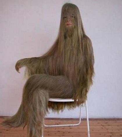 医生又查了父母的身体,发现他们的基因也没有促使长毛的东西,搞不清