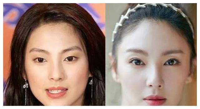 许多明星都毫不掩饰地承认接受了双眼皮手术,比如戚薇,景甜等知名人士