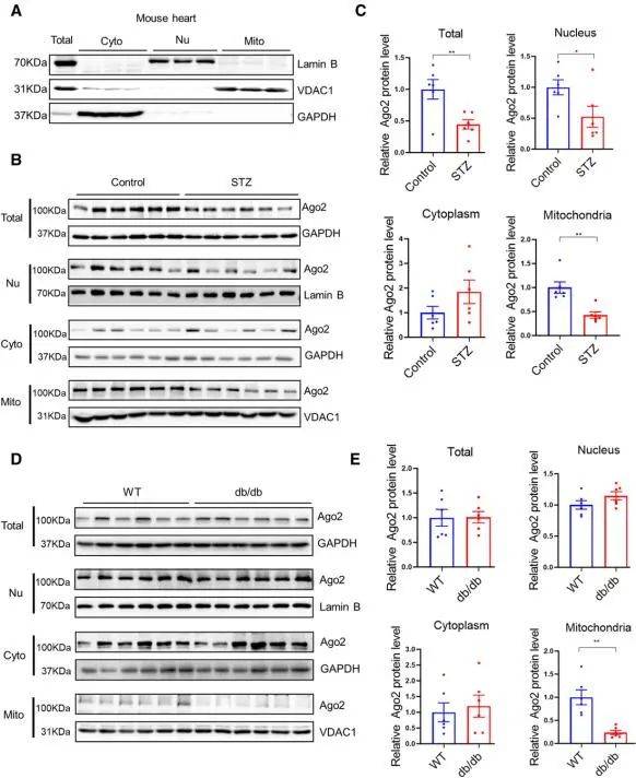 circulation汪道文李华萍陈琛团队发现糖尿病心肌病治疗新靶点