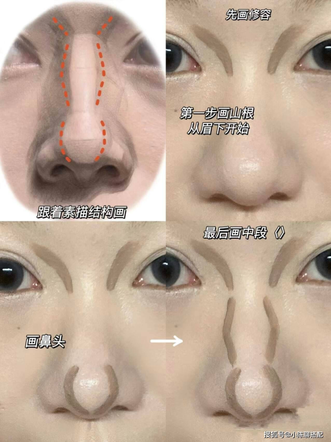 肉鼻子和蒜头鼻区别图片