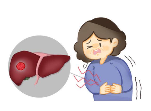 对于许多年轻人而言,他们在体检中意外发现自己患有肝囊肿,可能会感到