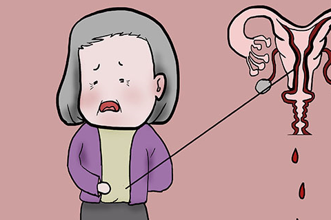 女人有妇科炎症别慌多喝这6种水或能让炎症慢慢消失