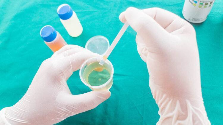 健康的照妖镜尿常规检查时有哪些注意事项结果异常怎么办