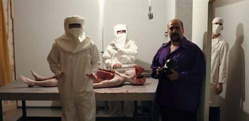 声称被外星人绑架52次,手臂上的特殊伤痕可以证明_宝拉·史密斯_人类