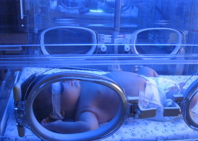 宝宝出生黄疸高,医生非要让照蓝光,别再折磨宝宝了!_护理_新生儿_保护