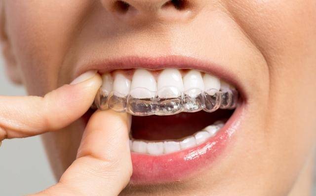 牙齿矫正正畸须知远离19大护理副作用雷区