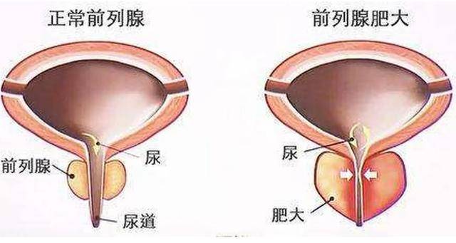 男性_生活_影响