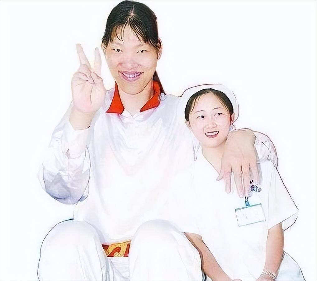 实际上,如果父母足够细心,巨人症是可以得到早期治疗的